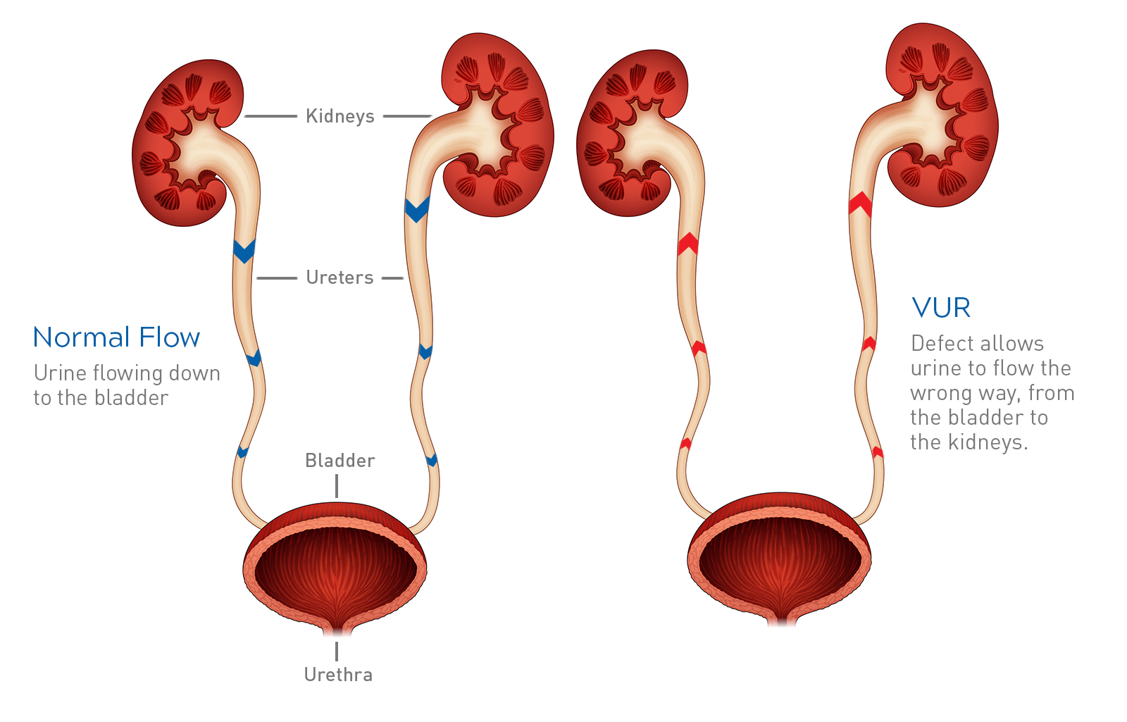 What Does The Root In The Term Reflux Mean